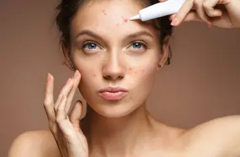How Hyaluronic Acid Helps Acne-Prone Skin Stay Hydrated How Hyaluronic Acid Helps Acne-Prone Skin Stay Hydrated