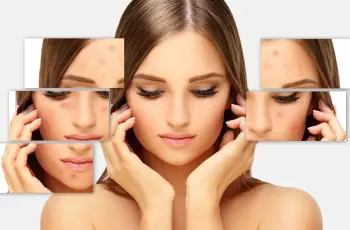 Understanding Lactic Acid and Skin Purging: A Skincare Guide