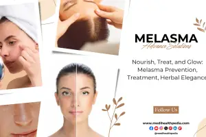 Understanding Melasma: Causes, Skincare Tips, and Treatment Solutions