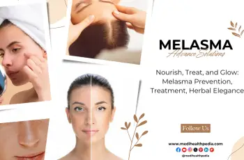 Understanding Melasma: Causes, Skincare Tips, and Treatment Solutions