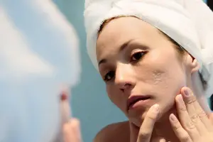 Scar Revision: Effective Treatments to Improve Skin’s Appearance