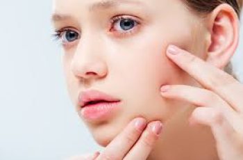 How Long Does Acne Take to Heal With Proper Skincare? How Long Does Acne Take to Heal With Proper Skincare?