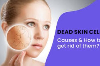Dead Skin Cells: Causes, Effects, and How to Remove Them for Smoother Skin Dead Skin Cells: Causes, Effects, and How to Remove Them for Smoother Skin