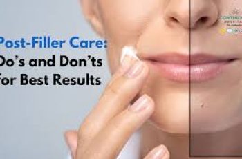 Essential Skin Care After Dermal Fillers to Minimize Swelling