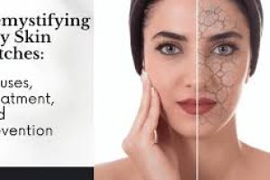 Scaly Skin Patches: Causes, Treatments, and Skincare Solutions