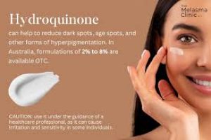 Skincare Strategies to Treat and Prevent Melasma and Hyperpigmentation