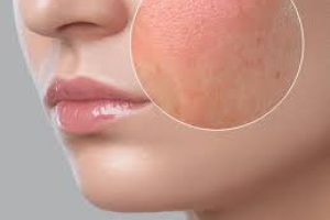Dry Skin or Just Dehydrated? Here’s How to Know for Sure