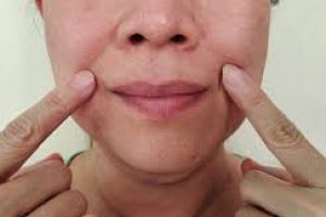 Effective Skincare Tips to Reduce Deep Wrinkles Around the Mouth