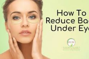 Skincare Tips to Treat and Prevent Under-Eye Bags Naturally