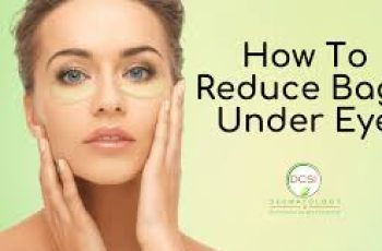 Skincare Tips to Treat and Prevent Under-Eye Bags Naturally Skincare Tips to Treat and Prevent Under-Eye Bags Naturally