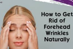 Skincare and Lifestyle Tips to Smooth Forehead Wrinkles Naturally