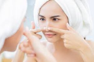 Skincare Guide to Removing Nose Blackheads Safely and Effectively