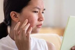 Proven Skincare Routine to Clear Acne Naturally at Home