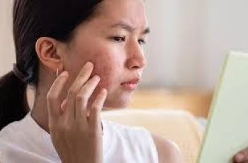Proven Skincare Routine to Clear Acne Naturally at Home Proven Skincare Routine to Clear Acne Naturally at Home