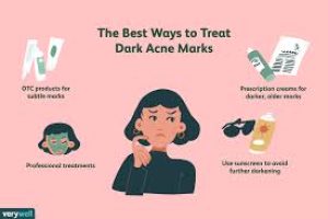 How Skincare Helps Clear Post-Inflammatory Hyperpigmentation from Within