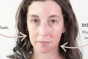 Effective Skin Care: How BHA Exfoliants Transform Your Skin