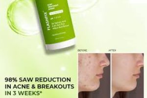 Salicylic Acid Routine for Acne: Tips, Frequency, and Benefits