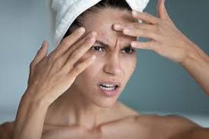 When Skin Struggles Fuel Anxiety: Healing Beyond the Surface