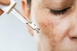 How Kojic Acid Works: Your Ultimate Guide to Clearer, Brighter Skin