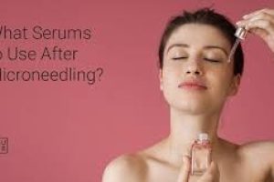 Lactic Acid After Microneedling: Skincare Safety and Timing Tips