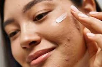 Does Moisturizer Help or Hurt Acne-Prone Skin? Does Moisturizer Help or Hurt Acne-Prone Skin?