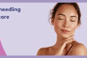 How to Safely Use Vitamin C After Microneedling Treatments