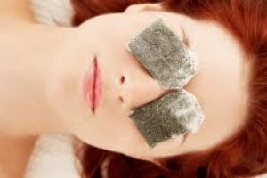 How to Get Rid of Dark Circles: Causes and Effective Treatments