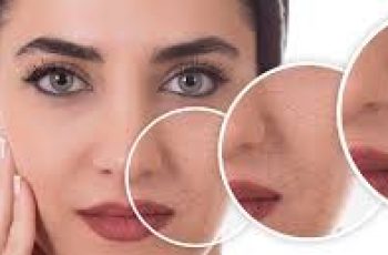 Which Dry Skin Type Are You? Learn and Treat It