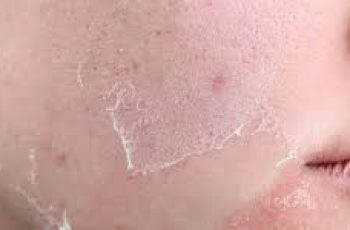 Exfoliation vs. Desquamation: How Skin Naturally Renews Itself