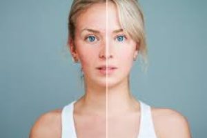 What Happens to Your Skin When You Quit Alcohol