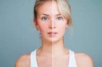 What Happens to Your Skin When You Quit Alcohol