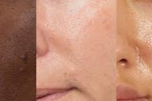 How to Reduce Enlarged Pores: Myths, Truths, and Skincare Tips