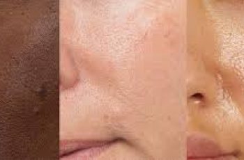 How to Reduce Enlarged Pores: Myths, Truths, and Skincare Tips