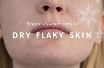 How to Get Rid of Dry Skin Fast This Winter