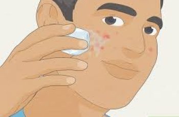 How to Get Rid of Pimples Fast: Science-Backed Tips for Clearer Skin How to Get Rid of Pimples Fast: Science-Backed Tips for Clearer Skin