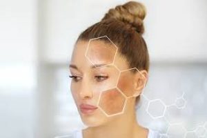 How to Get Rid of Face Spots Fast: Effective Tips for Clear, Radiant Skin