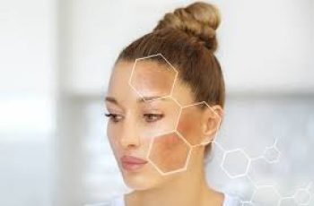 How to Get Rid of Face Spots Fast: Effective Tips for Clear, Radiant Skin How to Get Rid of Face Spots Fast: Effective Tips for Clear, Radiant Skin