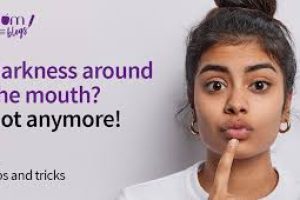Skincare Strategies to Fade Dark Spots Around the Mouth