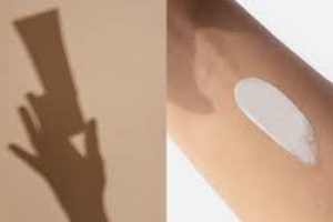 How to Take Care of Your Skin After Sun Exposure