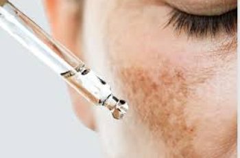 How to Fade Melasma Internally for Clearer Skin