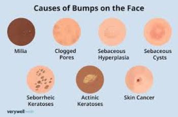 White Bumps on Skin: 7 Reasons and Fixes That Work White Bumps on Skin: 7 Reasons and Fixes That Work