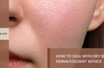 Dermatologist Tips for Dry, Red, and Itchy Skin