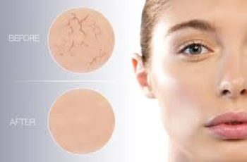 How to Tell If Your Skin’s Dehydrated—and What to Do About It