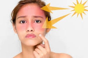 Can Retinol and Sunbeds Coexist? Why This Combo May Harm Your Skin