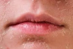 Essential Skincare Tips for Treating Scaly, Rough Skin Patches
