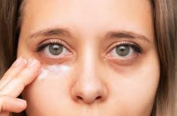 Say Goodbye to Under-Eye Bags: Causes, Prevention, and Treatments