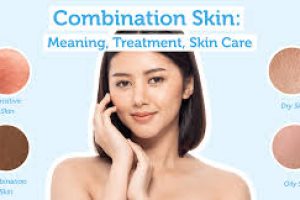 What Combination Skin Really Means and How to Treat It