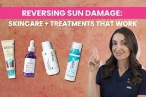Sun Damage Treatment Guide: Top Dermatologist-Approved Solutions