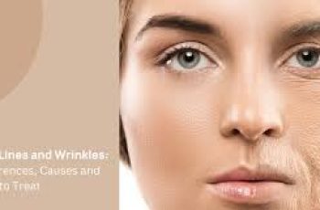 Fine Lines vs Wrinkles: Your Skincare Guide to Aging Gracefully Fine Lines vs Wrinkles: Your Skincare Guide to Aging Gracefully