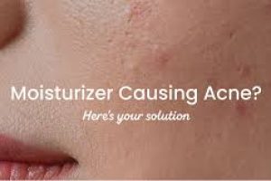 Does Moisturizer Help or Hurt Acne-Prone Skin?